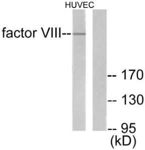 Anti-Factor VIII heavy chain Rabbit Polyclonal Antibody