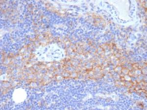 Immunohistochemical analysis of formalin-fixed, paraffin-embedded human lymph node using Anti-ICAM1 Antibody [P2A4]