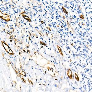 Immunohistochemistry analysis of paraffin-embedded human placenta using Anti-CD31 Antibody [ARC50355] (A305351) at a dilution of 1:1,000 (40x lens) Perform high pressure antigen retrieval with 10 mM citrate buffer pH 60 before commencing with IHC staining protocol