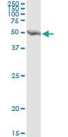 Anti-GART Mouse Monoclonal Antibody [clone: 4D6-1D5]