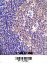 Anti-PIK3R5 Rabbit Polyclonal Antibody (APC (Allophycocyanin))