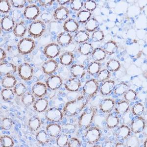 Immunohistochemistry analysis of paraffin-embedded mouse kidney using Anti-MT-ND1 Antibody (A93262) at a dilution of 1:100 (40x lens). Perform microwave antigen retrieval with 10 mM PBS buffer pH 7.2 before commencing with IHC staining protocol