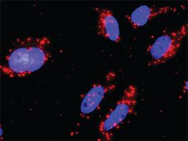 Anti-PIK3R1 + PIK3CB Antibody Pair