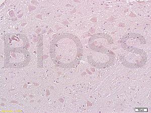 Anti-MAP1A Rabbit Polyclonal Antibody