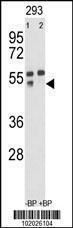 Anti-MMP12 Rabbit Polyclonal Antibody (Biotin)