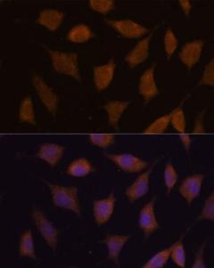 Immunofluorescence analysis of L929 cells using Anti-FBXW8 Antibody (A309160) at a dilution of 1:100 DAPI was used to stain the cell nuclei (blue)