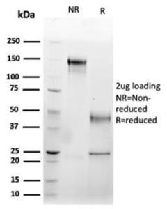 SDS-PAGE analysis of Anti-Fas Ligand Antibody [FASLG/4456] under non-reduced and reduced conditions; showing intact IgG and intact heavy and light chains, respectively. SDS-PAGE analysis confirms the integrity and purity of the antibody.