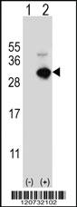 Anti-GSTO1 Rabbit Polyclonal Antibody