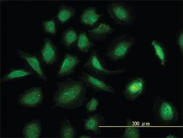 Anti-GART Mouse Monoclonal Antibody [clone: 4D6-1D5]