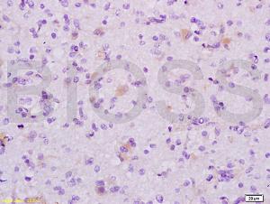 Anti-MAP1A Rabbit Polyclonal Antibody