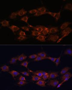 Immunofluorescence analysis of C6 cells using Anti-MT-ND1 Antibody (A93262) at a dilution of 1:100 (40x lens). DAPI was used to stain the cell nuclei (blue)