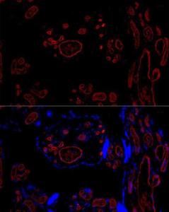 Immunohistochemistry analysis of paraffin-embedded human tonsil using Anti-CD31 Antibody [ARC50355] (A305351) at a dilution of 1:1,000 (40x lens) Perform high pressure antigen retrieval with 10 mM citrate buffer pH 60 before commencing with IHC staining protocol