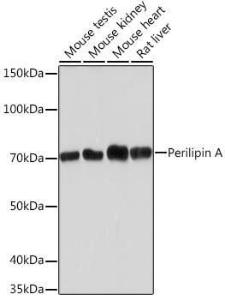 Western blot analysis of extracts of various cell lines, using Anti-Perilipin-1 Antibody [ARC1122] (A306256) at 1:1,000 dilution