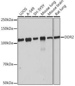 Anti-DDR2 Rabbit Monoclonal Antibody [clone: ARC0958]