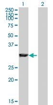 Anti-GAS2 Rabbit Polyclonal Antibody