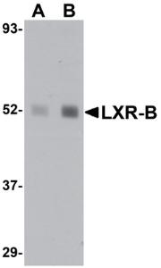 Anti-NR1H2 Rabbit Polyclonal Antibody