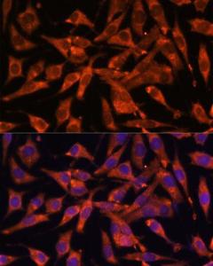 Immunofluorescence analysis of L929 cells using Anti-MT-ND1 Antibody (A93262) at a dilution of 1:100 (40x lens). DAPI was used to stain the cell nuclei (blue)