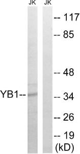 Western blot analysis of lysates from Jurkat cells using Anti-YB1 Antibody. The right hand lane represents a negative control, where the Antibody is blocked by the immunising peptide