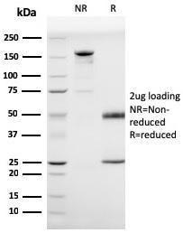 SDS-PAGE analysis of Anti-Prohibitin Antibody [PHB/3225] under non-reduced and reduced conditions; showing intact IgG and intact heavy and light chains, respectively. SDS-PAGE analysis confirms the integrity and purity of the antibody