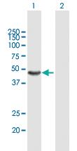 Anti-AMBP Mouse Polyclonal Antibody