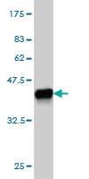 Anti-BIK Mouse Monoclonal Antibody [clone: 4G12]