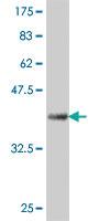 Anti-USP5 Mouse Polyclonal Antibody