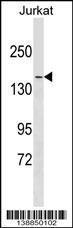 Anti-MYH9 Rabbit Polyclonal Antibody (AP (Alkaline Phosphatase))