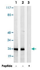 Anti-AKR1E2 Rabbit Polyclonal Antibody