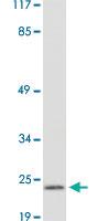 Anti-PRSS1 Rabbit Polyclonal Antibody