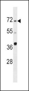 Anti-SPHK2 Rabbit Polyclonal Antibody (HRP (Horseradish Peroxidase))