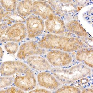 Immunohistochemistry analysis of paraffin-embedded rat kidney using Anti-ND4 Antibody (A93263) at a dilution of 1:200 (40x lens). Perform high pressure antigen retrieval with 10 mM citrate buffer pH 6.0 before commencing with IHC staining protocol.