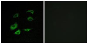 Immunofluorescence analysis of HepG2 cells using Anti-Cyclosome 1 Antibody. The right hand panel represents a negative control, where the antibody was pre-incubated with the immunising peptide