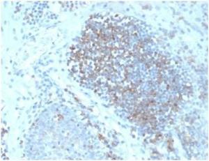 Immunohistochemical analysis of formalin-fixed, paraffin-embedded human lymph node tissue using Anti-Fas Ligand Antibody [FASLG/4456]