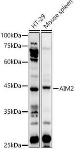 Western blot analysis of extracts of various cell lines, using Anti-AIM2 Antibody (A9191) at 1:1,000 dilution. The secondary antibody was Goat Anti-Rabbit IgG H&L Antibody (HRP) at 1:10,000 dilution. Lysates/proteins were present at 25µg per lane.