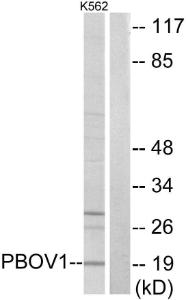 Western blot analysis of lysates from K562 cells using Anti-PBOV1 Antibody The right hand lane represents a negative control, where the antibody is blocked by the immunising peptide