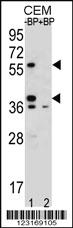 Anti-MNDA Rabbit Polyclonal Antibody [clone: 143CT50.11.8]