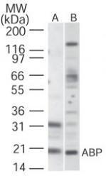 Anti-RBFOX1 Mouse Monoclonal Antibody (DyLight® 488) [clone: D8H8]