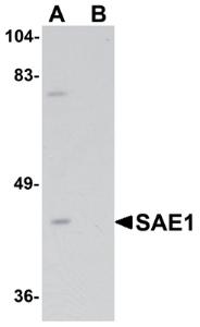 Anti-SAE1 Rabbit Polyclonal Antibody