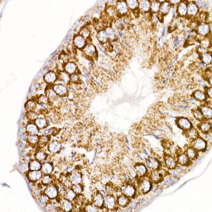 Immunohistochemistry analysis of paraffin-embedded rat ovary using Anti-ND4 Antibody (A93263) at a dilution of 1:200 (40x lens). Perform high pressure antigen retrieval with 10 mM citrate buffer pH 6.0 before commencing with IHC staining protocol.