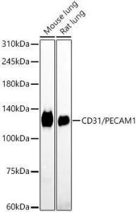 Immunohistochemistry analysis of paraffin-embedded human tonsil using Anti-CD31 Antibody [ARC50362] (A305352) at a dilution of 1:600(40x lens)