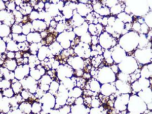 Immunohistochemistry analysis of paraffin-embedded rat brown adipose using Anti-Perilipin-1 Antibody [ARC1122] (A306256) at a dilution of 1:100 (40X lens). Perform microwave antigen retrieval with 10 mM PBS buffer pH 7.2 before commencing with IHC staining protocol