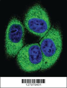 Anti-TSSK4 Rabbit Polyclonal Antibody [clone: 147CT8.3.4]