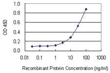 Anti-RAB34 Mouse Monoclonal Antibody [clone: 3A5]