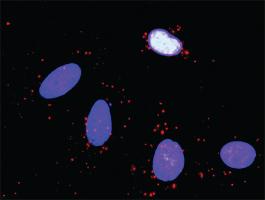 Anti-PIK3R1 + SOS1 Antibody Pair