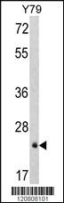 Anti-GSTP1 Rabbit Polyclonal Antibody