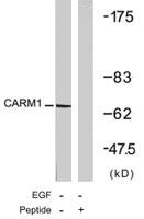 Anti-CARM1 Rabbit Polyclonal Antibody