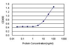 Anti-GTF2E1 Polyclonal Antibody Pair