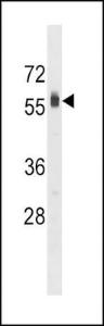 Anti-SPHK2 Rabbit Polyclonal Antibody (APC (Allophycocyanin))