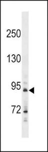 Anti-HHIP Rabbit Polyclonal Antibody (APC (Allophycocyanin))