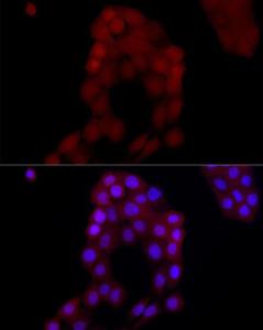 Immunofluorescence analysis of A-431 cells using Anti-AIM2 Antibody (A9191) at a dilution of 1:50 (40x lens). DAPI was used to stain the cell nuclei (blue).